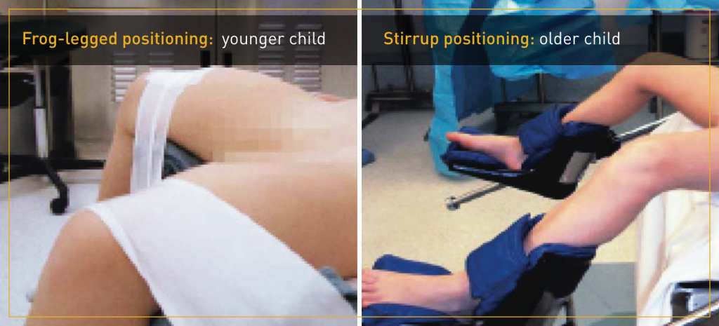 PatientPositioning_image-1-1024x465